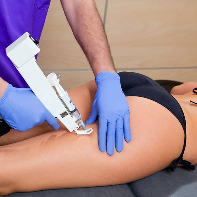 Meso Terapia Estetica | Fisiomakbi.it