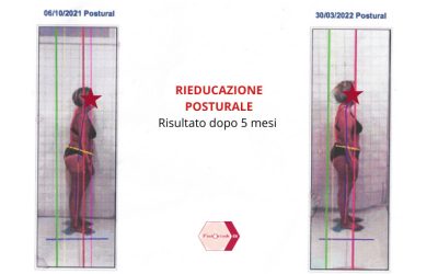 La rieducazione posturale, correggi le posizioni errate assunte dal tuo corpo