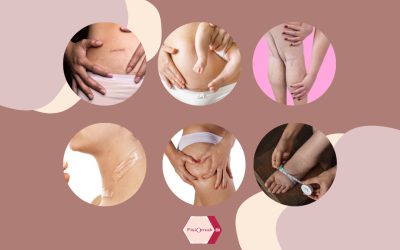 Inestetismi cutanei? Prepara la pelle all’estate con i trattamenti specialistici di Fisiomakbi