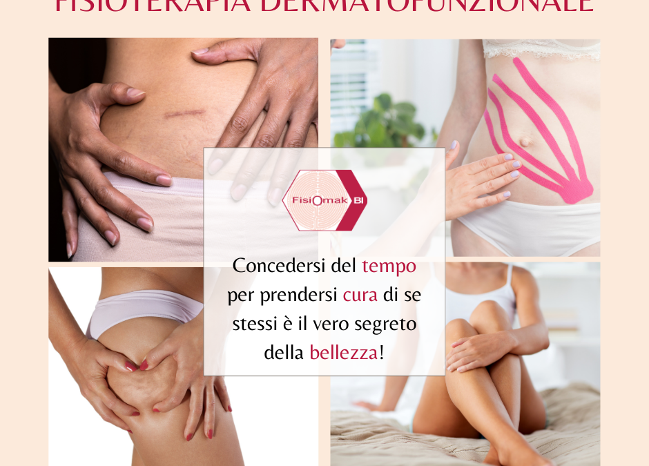 Fisioterapia dermatofunzionale a Prato