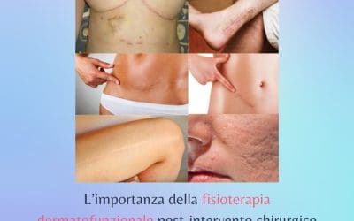 L’importanza della fisioterapia dermatofunzionale post-intervento chirurgico